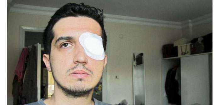 Gezi’de gözünü kaybeden akademisyen İçişleri'ni tazminata mahkum ettirdi