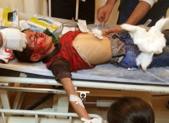 10 yaşındaki Mehmet gaz fişeğiyle vuruldu